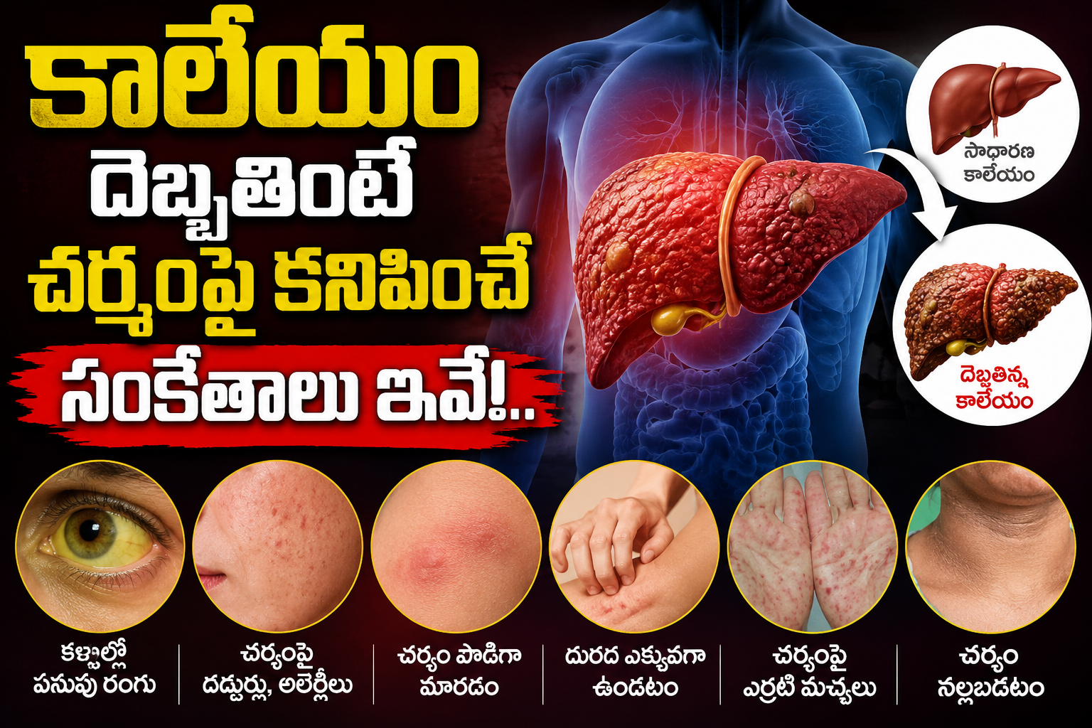 Health: కాలేయం దెబ్బతింటే చర్మంపై కనిపించే సంకేతాలు ఇవే!..